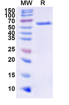Recombinant Human NEUROD1 Protein, N-His-KSI
