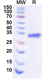 Recombinant Human EVI2B Protein, N-His-KSI