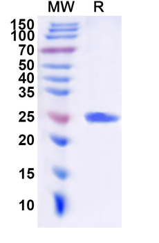Recombinant Human SLC6A1 Protein, N-His-KSI