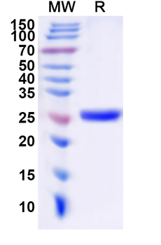 Recombinant Human HTR2C Protein, N-His-KSI