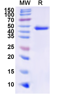 Recombinant Human HOXB9 Protein, N-His-KSI