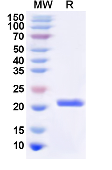 Recombinant Human RPS2 Protein, N-His