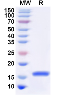 Recombinant Human PAX1 Protein, N-His
