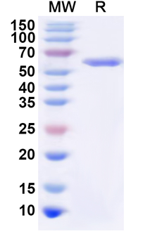 Recombinant Acinetobacter calcoaceticus ALDH Protein, N-His
