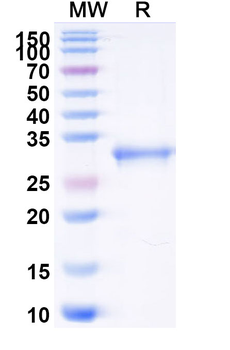 Recombinant Mouse CD91/LRP1 Protein, N-His