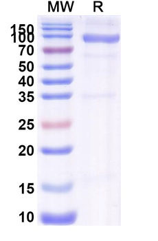 Recombinant PEDV S/Spike glycoprotein Protein, C-His
