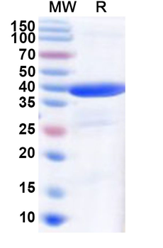 Stable Receptor Related Protein (RAP) LRP1 Inhibitor