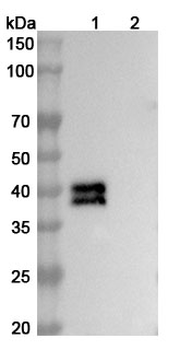 Recombinant HMPV F/Fusion glycoprotein F0 Protein, C-His