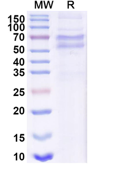 Recombinant HMPV F/Fusion glycoprotein F0 Protein, C-His