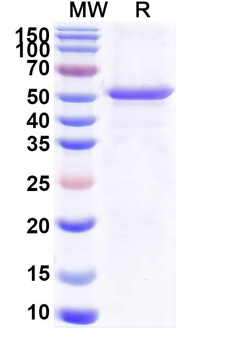 Recombinant Common timothy PHLPIV/Phl p 4 Protein, N-His