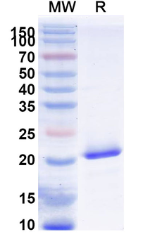 Recombinant Human SCN9A Protein, N-His