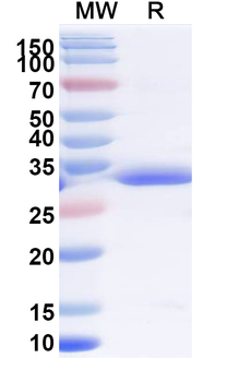 Recombinant Human SSBP1 Protein, N-His