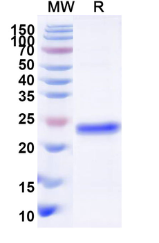 Human DNMT1 Recombinant Protein (N-His)