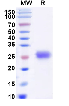 Recombinant Mouse CD40/TNFRSF5 Protein, C-His