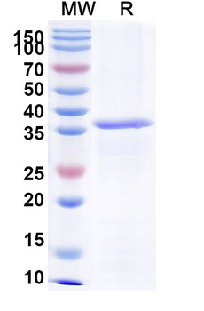 Recombinant EV71 VP1/Capsid protein VP1 Protein, N-His