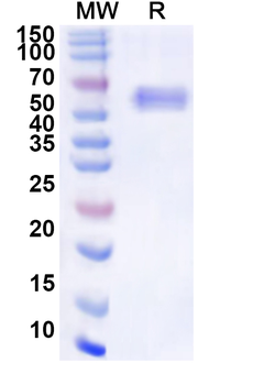 Recombinant Nipah virus/NiV Protein N/Nucleoprotein Protein, N-His