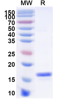 Recombinant Clostridioides difficile Toxin A/tcdA Protein, N-His
