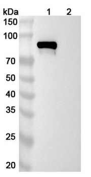 Recombinant Human CD71/TFRC Protein, C-His