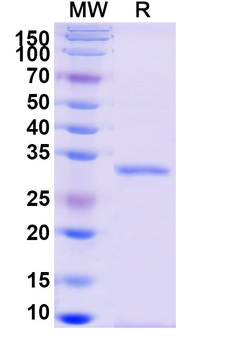 Recombinant Monkeypox virus/MPXV A14L Protein, N-GST & C-His
