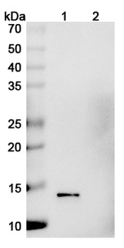 Recombinant Monkeypox virus/MPXV A29L Protein, C-His