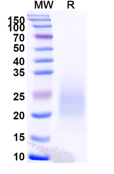 Recombinant Monkeypox virus/MPXV M1R Protein, C-His