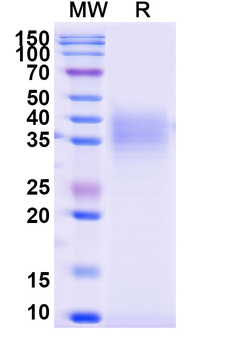 Recombinant Monkeypox virus/MPXV E8L Protein, C-His