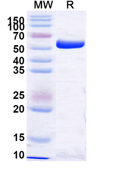 Recombinant Influenza A virus (H1N1) NP/Nucleoprotein Protein, N-His