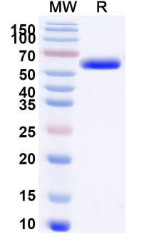 Human STK39 Recombinant Protein (N-His)