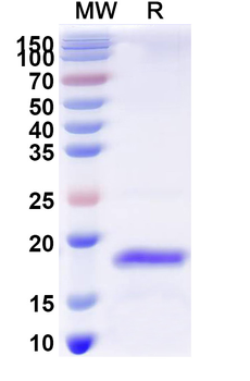 Human DNMT3B Recombinant Protein (N-His)