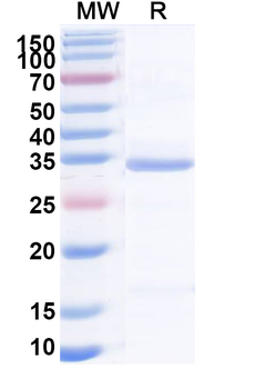 Recombinant Human PAK2 Protein, N-His