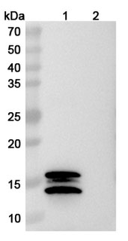 Recombinant Human IL2 Protein, C-His