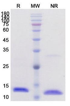 Recombinant Human IL2 Protein, C-His