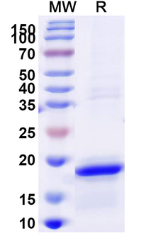 Recombinant Human JAK3 Protein, N-His