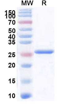 Human ADCY7 Recombinant Protein (N-His)