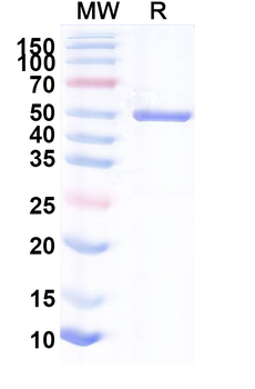 Recombinant Human AHCY Protein, N-His