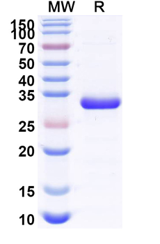 Recombinant Human JAK1 Protein, N-His
