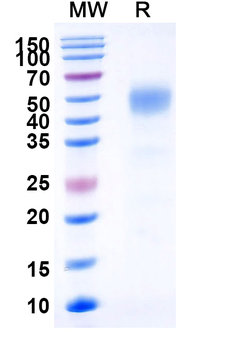 Recombinant Human CD332/FGFR2 Protein, C-His