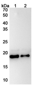 Recombinant Human IL11 Protein, N-His