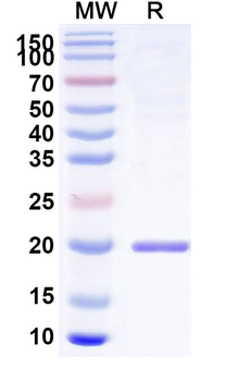 Recombinant Human IL11 Protein, N-His