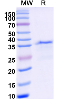 Recombinant Human CD11a/ITGAL Protein, N-His