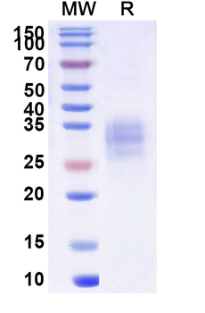 Recombinant Human CD120a/TNFRSF1A Protein, C-His