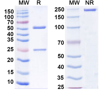 Mycobacterium tuberculosis acp-1 Human Monoclonal Antibody