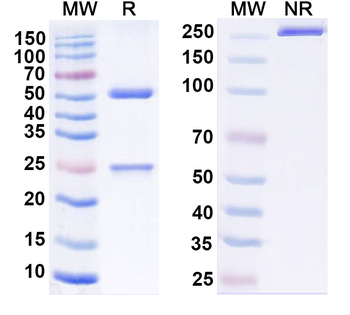 Mycobacterium tuberculosis acp-1 Human Monoclonal Antibody