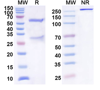 CA9 Mouse Monoclonal Antibody