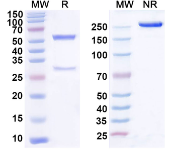 PDGFC Mouse Monoclonal Antibody