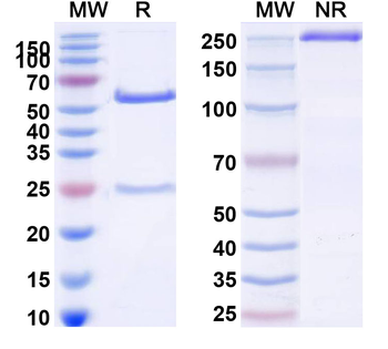 CD161/KLRB1/NK1.1 Mouse Monoclonal Antibody