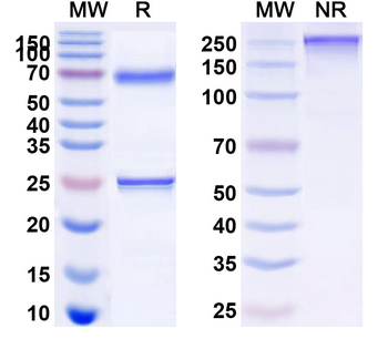 CD74 Human Monoclonal Antibody