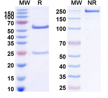 lgE Mouse Monoclonal Antibody