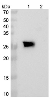 Cinrebafusp alfa Human Monoclonal Antibody