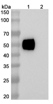 Lumistobart Human Monoclonal Antibody